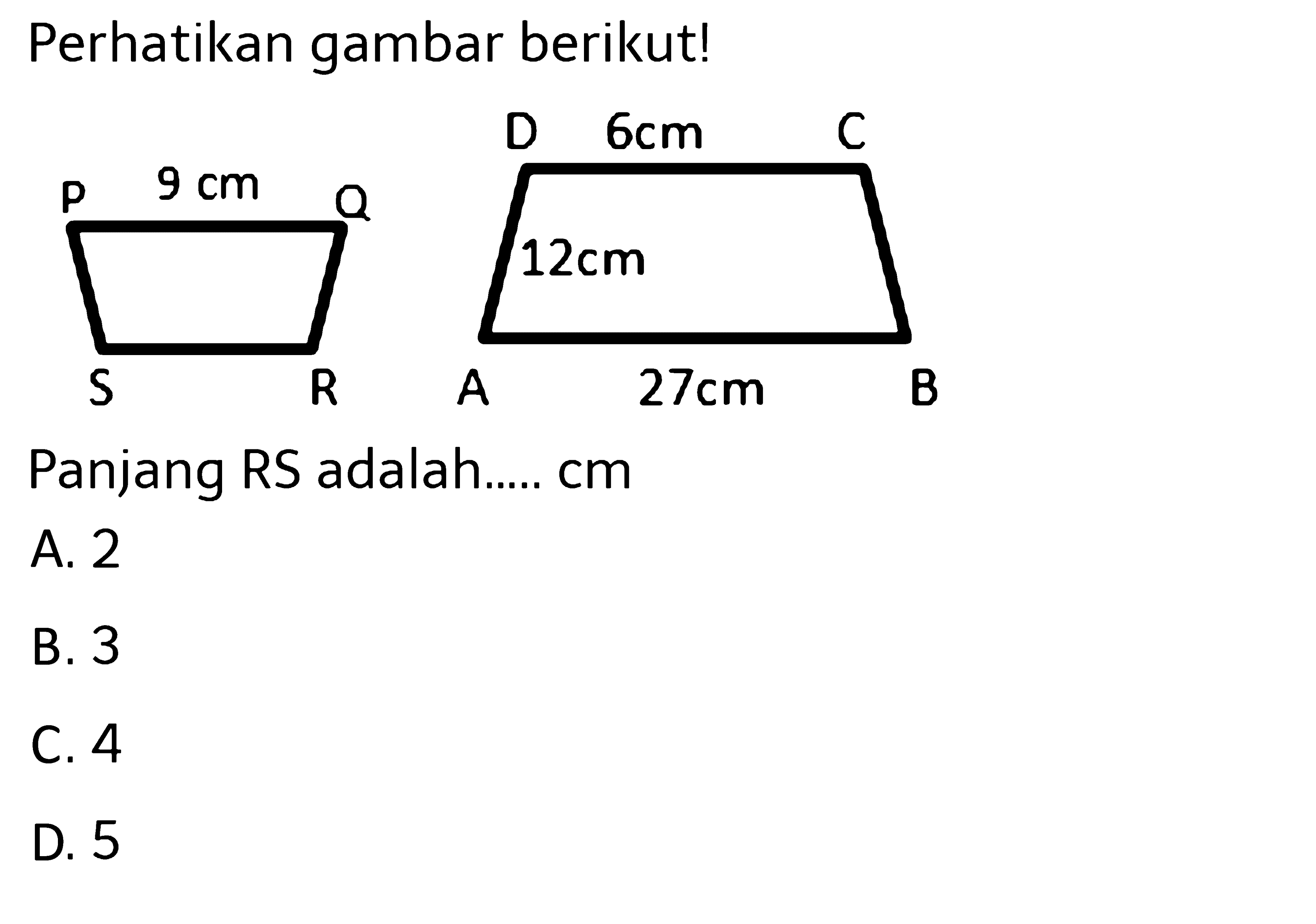 Perikan gambar berikut! Panjang RS adalah....cm