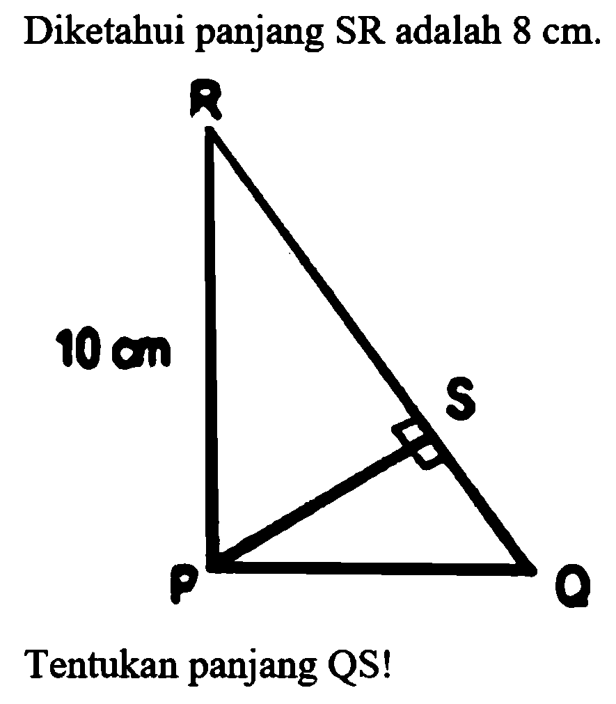 Diketahui panjang SR adalah 8 cm. 10 cm Tentukan panjang QS!