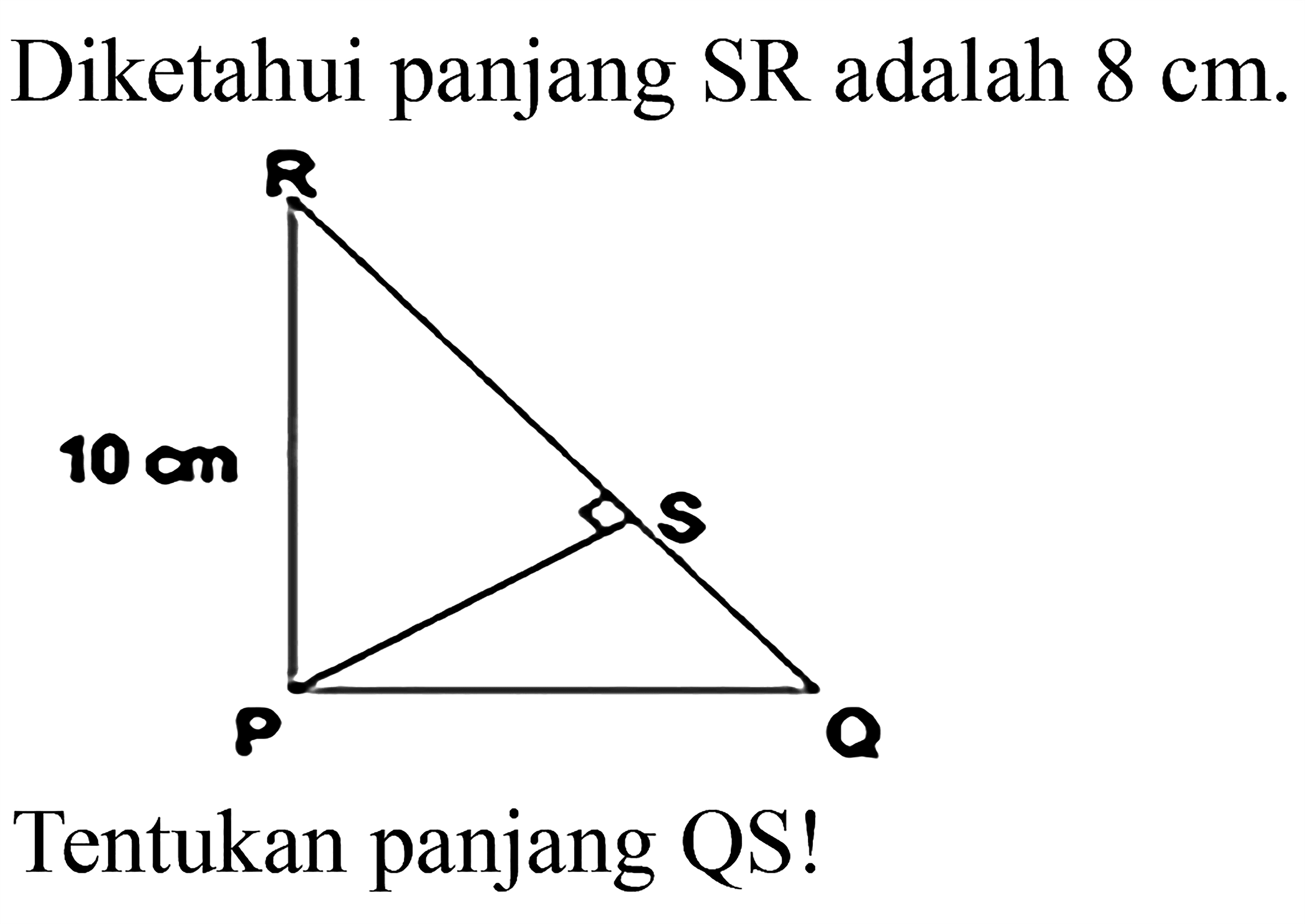 Diketahui panjang SR adalah  8 cm .Tentukan panjang QS! 10 cm