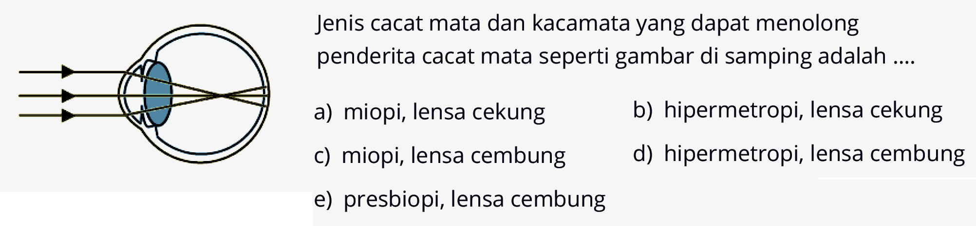 Jenis cacat mata dan kacamata yang dapat menolong penderita cacat mata seperti gambar di samping adalah ....