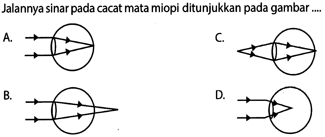 Jalannya sinar pada cacat mata miopi ditunjukkan pada gambar .... A. B. C. D.