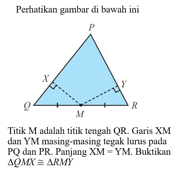 Perhatikan gambar di bawahiniTitik M adalah titik tengah QR. Garis XM dan YM masing-masing tegak lurus pada PQ dan PR. Panjang XM = YM. Buktikan  segitiga QMX kongruen segitiga RMY 